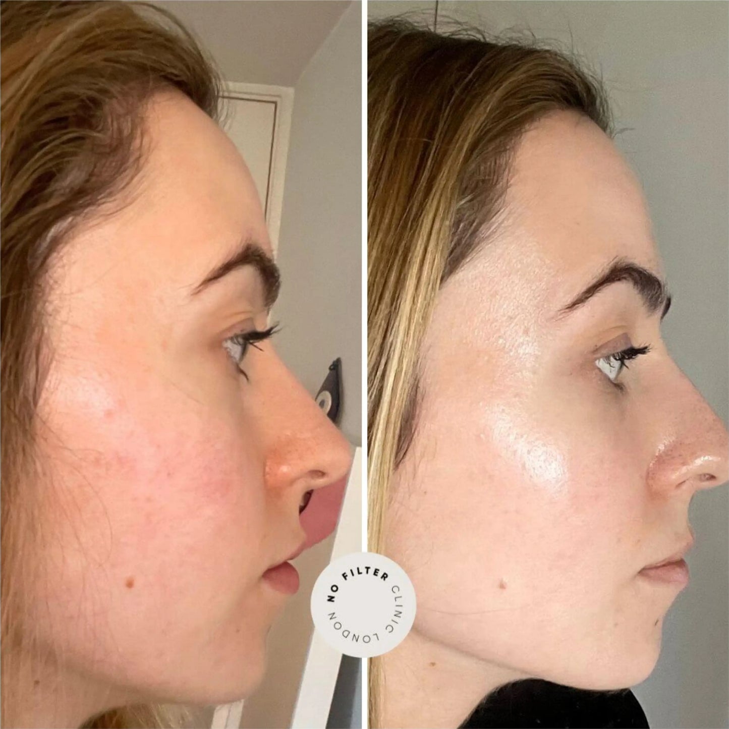 CryoGlow™: De-Puff, Tighten & Glow — Your 7-Day Skin Reset